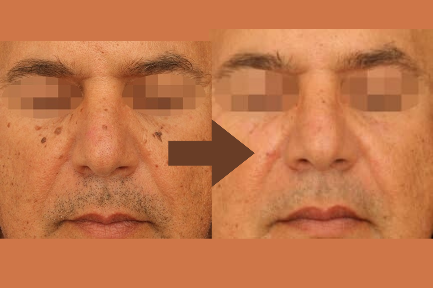 הבטחת תוצאות מרשימות ובטוחות בטכנולוגיה חדישה