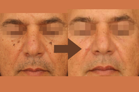 הבטחת תוצאות מרשימות ובטוחות בטכנולוגיה חדישה