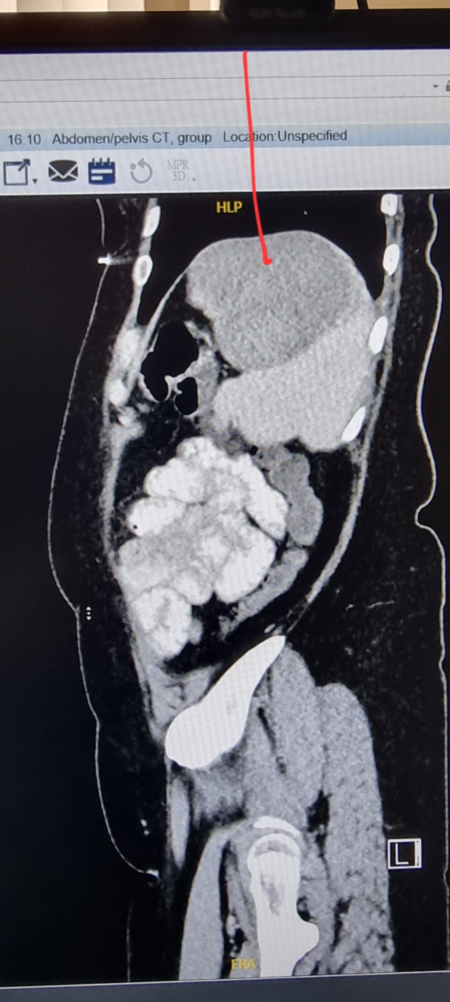 המטופלת ירדה במשקל ולא הבינה למה - ואז זה התגלה