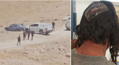 רועה הצאן החבול ותפיסת הפורע