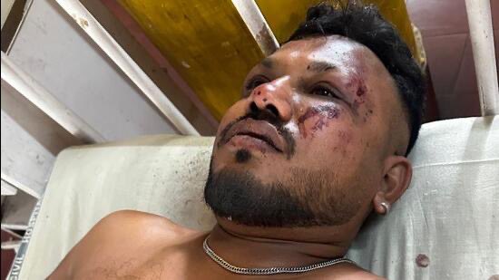 הניצול היחיד מההתרסקות