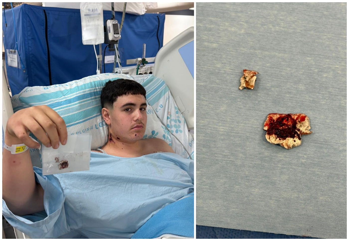 איתי עם הרסיס