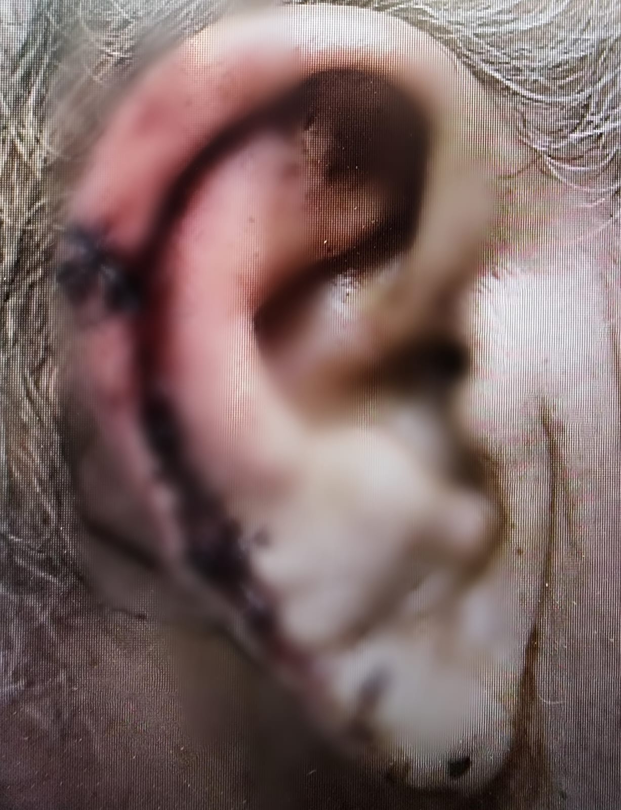 החבלות לנהג