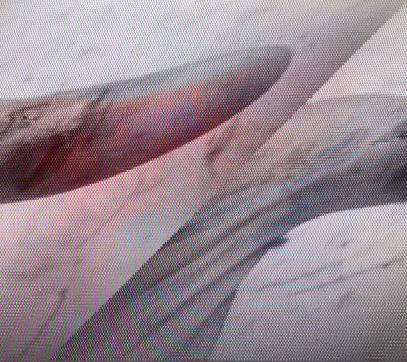 החבלות לנהג