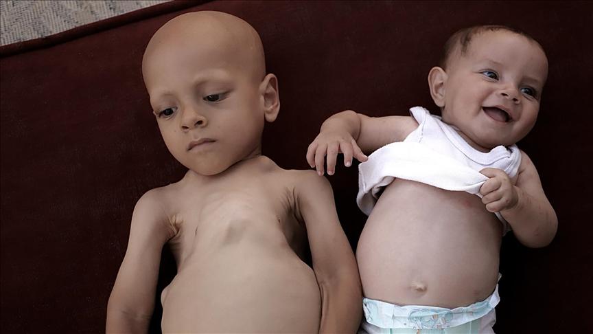 תמונותיו של הילד עבדאללה האני מחמד אבו זרקה שפורסמו ברשתות החברתיות