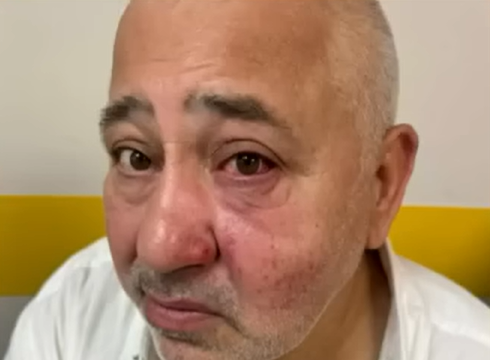 דוב סיטרוק שהותקף