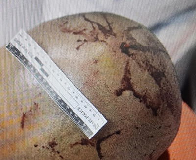 הפציעה בראש הקורבן