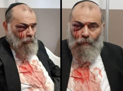 קשה לצפייה: "יהודי מלוכלך", צרח האנטישמי ופצע עד דם את החרדי
