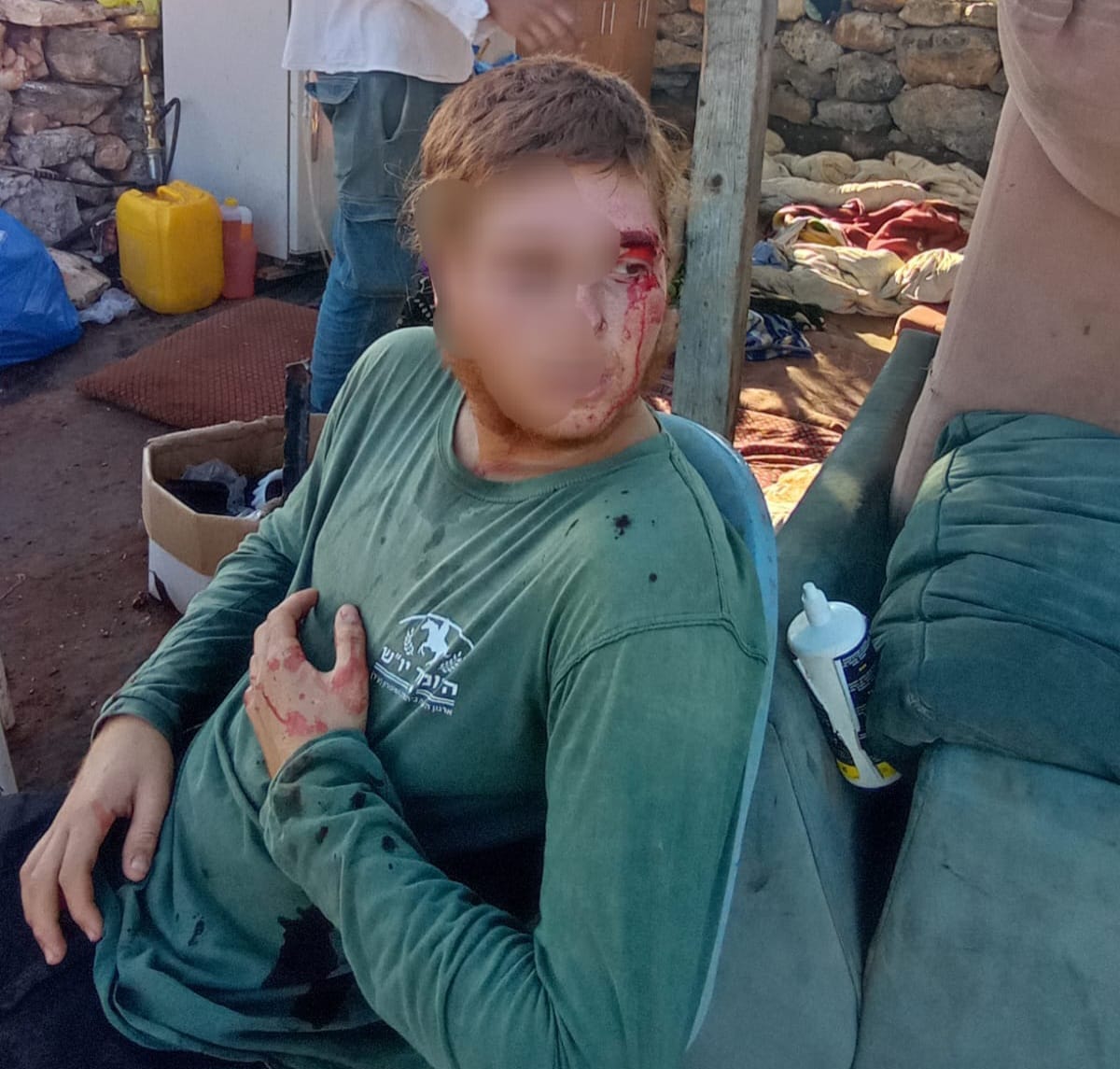 שוב טרור בחסות המסיק: רועה נפצע בראשו לאחר שהותקף בידי עשרות ערבים בשומרון