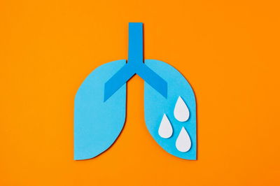 אילוסטרציה