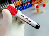 בדיקות סרטן