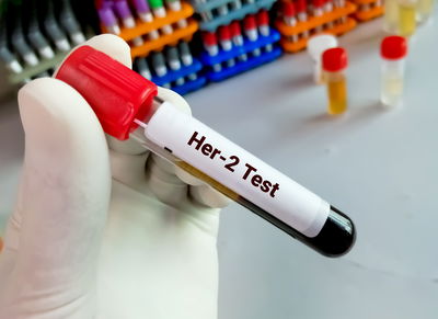 בדיקות סרטן