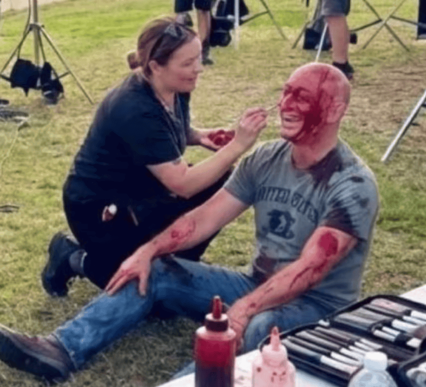 התמונה המזויפת שפורסמה ברשתות ומציגה את ארסן אוסטרובסקי כמי שזייף את פציעתו