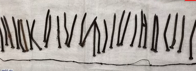 המסמרים שחולצו בבית החולים