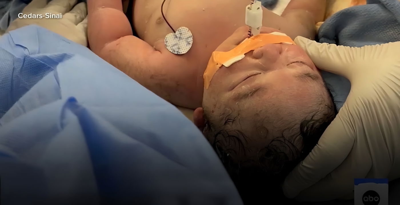 נס רפואי בארה"ב: הריון נדיר הסתיים בלידה שמחה ומסוכנת במיוחד | "כל הזמן התפללתי"