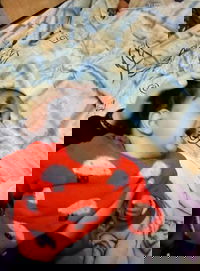 הפעוטה שנפגעה בראשה