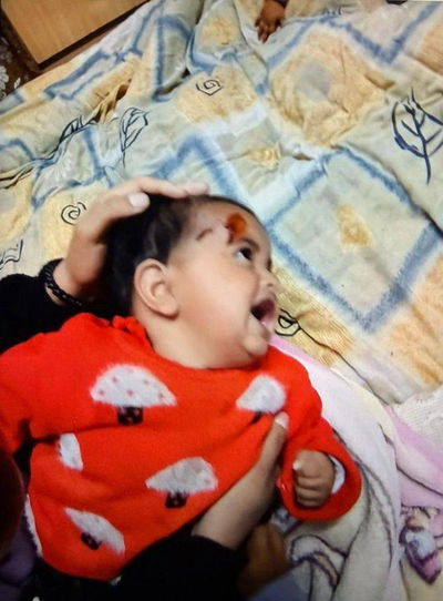 הפעוטה שנפגעה בראשה