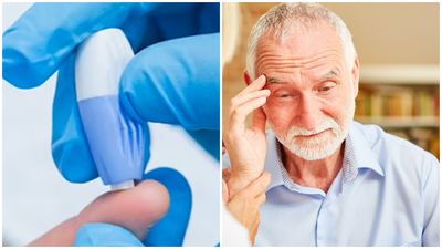  אלצהיימר: דקירה קטנה מספיקה כדי לזהות את המחלה