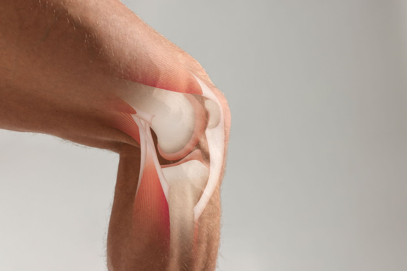 אילוסטרציה