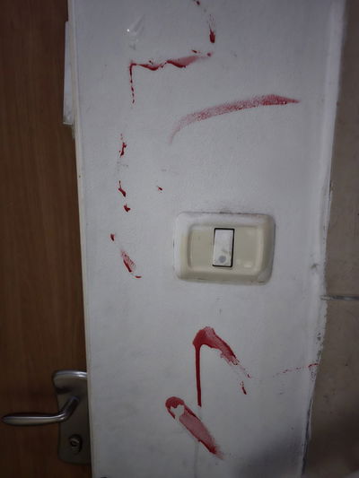 דם מהתקרית הקשה