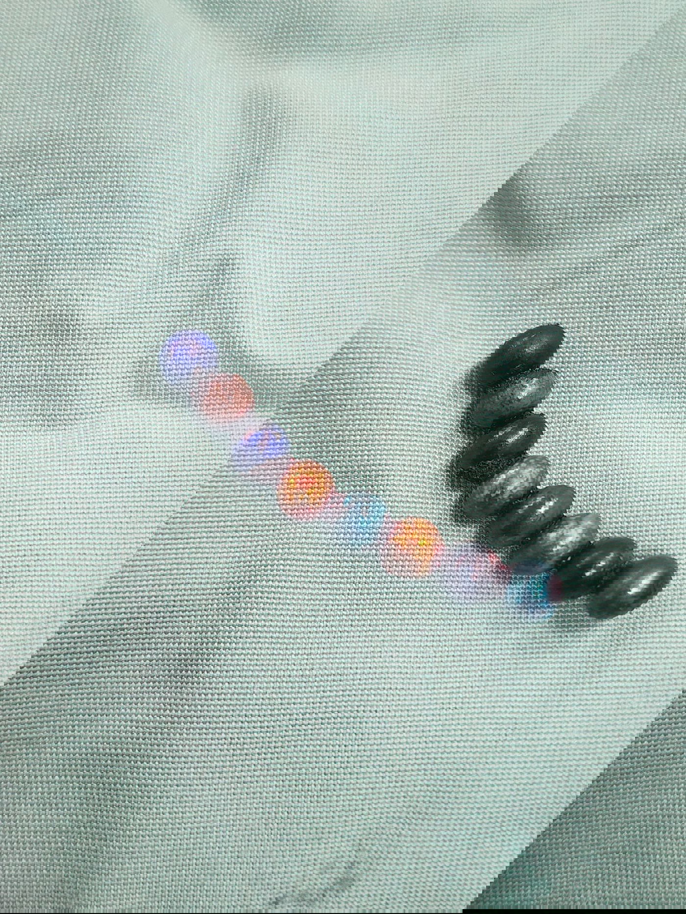 המגנטים שבלע הילד