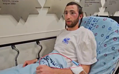 טיילו לתומם והותקפו על ידי עשרות ערבים: "עברתי לינץ', איבדתי את ההכרה"