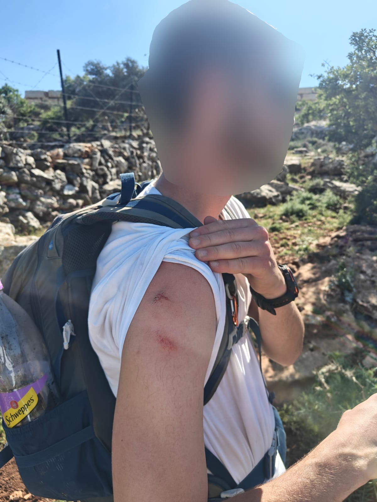 לינץ' מזעזע: עשרות פורעים תקפו קבוצת מטיילים מקרוב בסלעים ואבנים