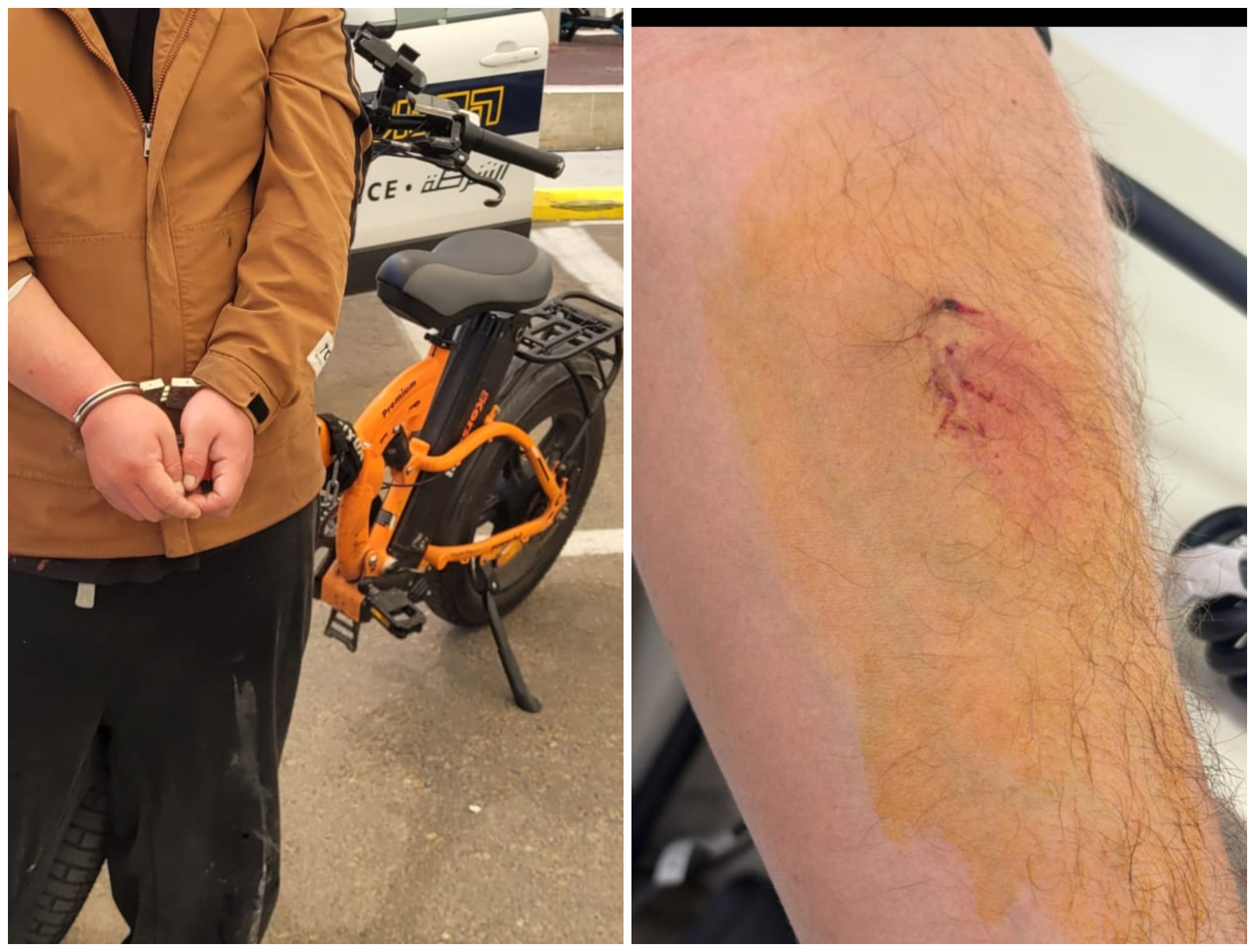 הנשיכה והמעצר