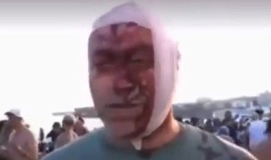 "מכוסה בקטשופ": הזיוף המרושע נגד ניצול פיגוע הטרור הרצחני בסידני