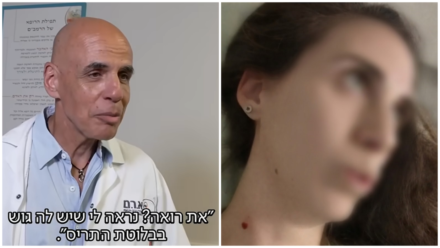 הצעירה מהתוכנית אחרי הטיפול - פרופסור אבי חפץ