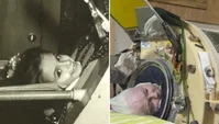 מרתה לילארד מחוברת לריאת הברזל - משמאל כילדה, מימין כמובגרת