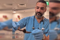 עטלף במזגן: נער ששמע רחשים מוזרים הגיע למיון של רמב"ם לאחר מפגש מסוכן