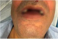 הנהג שהותקף