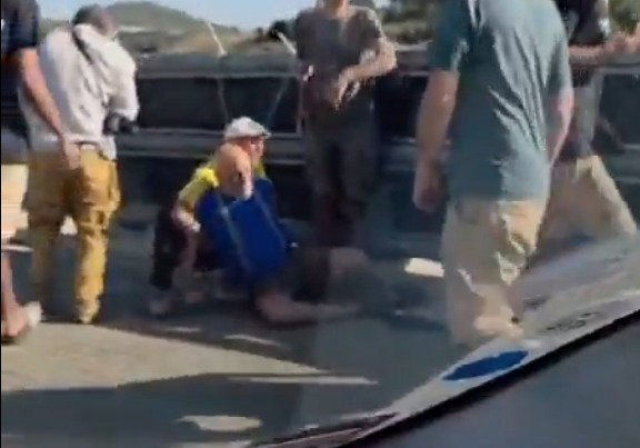 בגלל שלט מעל הכביש: הקשיש הותקף קשות - וגילה דימום במוח ימים לאחר מכן