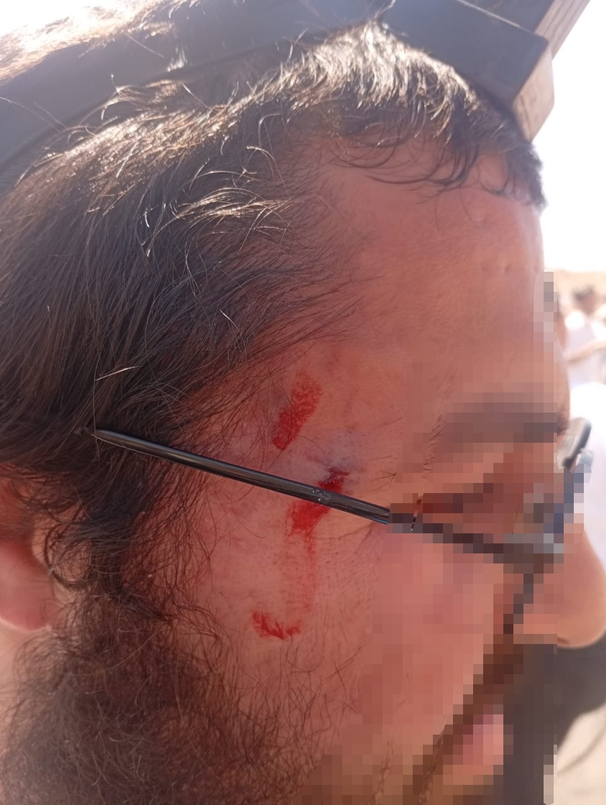 עימות ליד ההתנחלות החרדית: מחבלים תקפו מטיילים חרדים; הרבש"ץ ירה והרג מתפרע פלסטיני