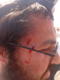 עימות ליד ההתנחלות החרדית: מחבלים תקפו מטיילים חרדים; הרבש"ץ ירה והרג מתפרע פלסטיני