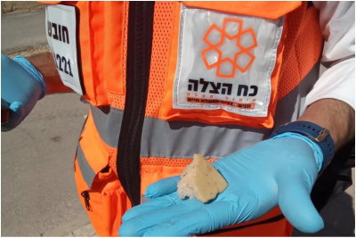 בני ברק: פעוט נחנק מחתיכת ספוג גדולה, כך הצילו את חייו ברגע האחרון