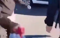 זוועה בצרפת: נער ניסה להשליך בחזרה רימון על שוטרים - היד שלו נתלשה בפיצוץ