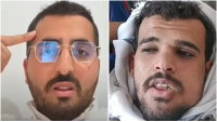 התימני שמתנגד לחות'ים ושונא את ישראל; "נדרוך לישראל על הצוואר" | צפו בריאיון